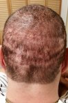Multi scar long before.jpg