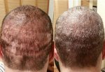 picture davido scar.jpg