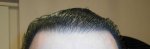 Hairline 26-11-14.jpg