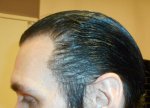 Left Side 26-11-14 Gel back.jpg