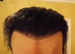 Hairline 7.5 Months.JPG