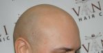 Before MSP treatment.jpg