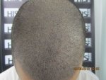 1month-after.jpg