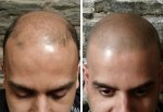 savio before after.jpg