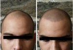 gabriel before after.jpg
