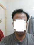 b4 procedure.jpg