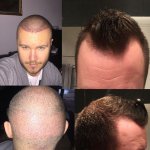 beforeAfter.jpg