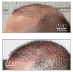 before-after-6.jpg