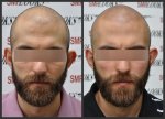 AlBefore&Afterfront.jpg