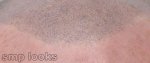 hairline-closeup.jpg