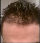 thinning badly.jpg