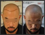 GiandownB&A.jpg