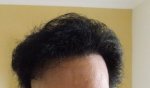 Hairline 11-10-15.jpg