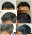 1 Year short C.jpg