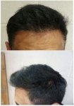1 Year short D.jpg