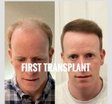 1st transplant.jpg