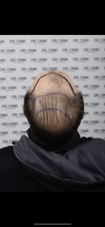424E9CB7-A117-4601-B5B8-425B1B8B61E0.png 424E9CB7-A117-4601-B5B8-425B1B8B61E0.png