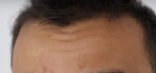 before.png