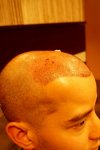 after surgery (4).jpg