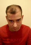 Without flash - profile photo.JPG