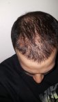 4th Month (4 days in).jpg