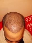 IMG_20160103_200255.jpg