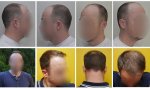 B4After-16-MOnths.jpg