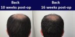 2-compared-back-wk-16.jpg