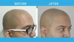 Prem Before and After.jpg