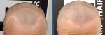 Before Vs After.JPG