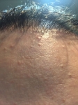 pluggy hairline.jpeg