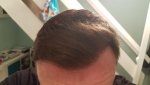 20170328_221802.jpg