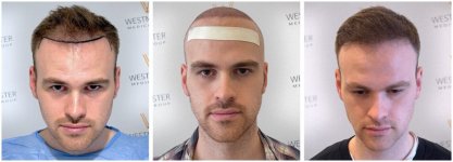 WMG FUE Harley St London 1.jpg