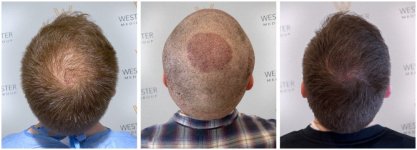 WMG FUE Harley St London 3.jpg