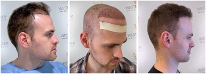 WMG FUE Harley St London 4.jpg