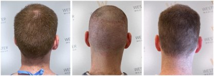 WMG FUE Harley St London 6.jpg