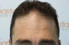 case #1 - before 2.png