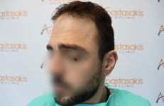 case #1 - before 4.png