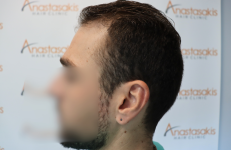 case #1 - before 6.png