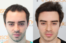 ΖΕΝΕΤΟΣ (1).png