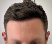 WMG London Hairline close up.jpg