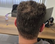 7. donor After.jpg