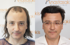 ΧΑΤΖΗΑΓΓΕΛΟΓΛΟΥ.png