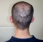 The back & Donor area.JPG