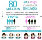 alopecia info1.jpg
