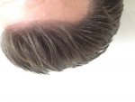 Dr. Bisanga patient result.JPG