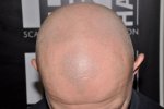 before treatment front.jpg