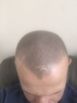 after treatment.jpg