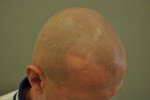 after treatment in bright light 1.jpg