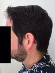12-months-left-profile-less.jpg